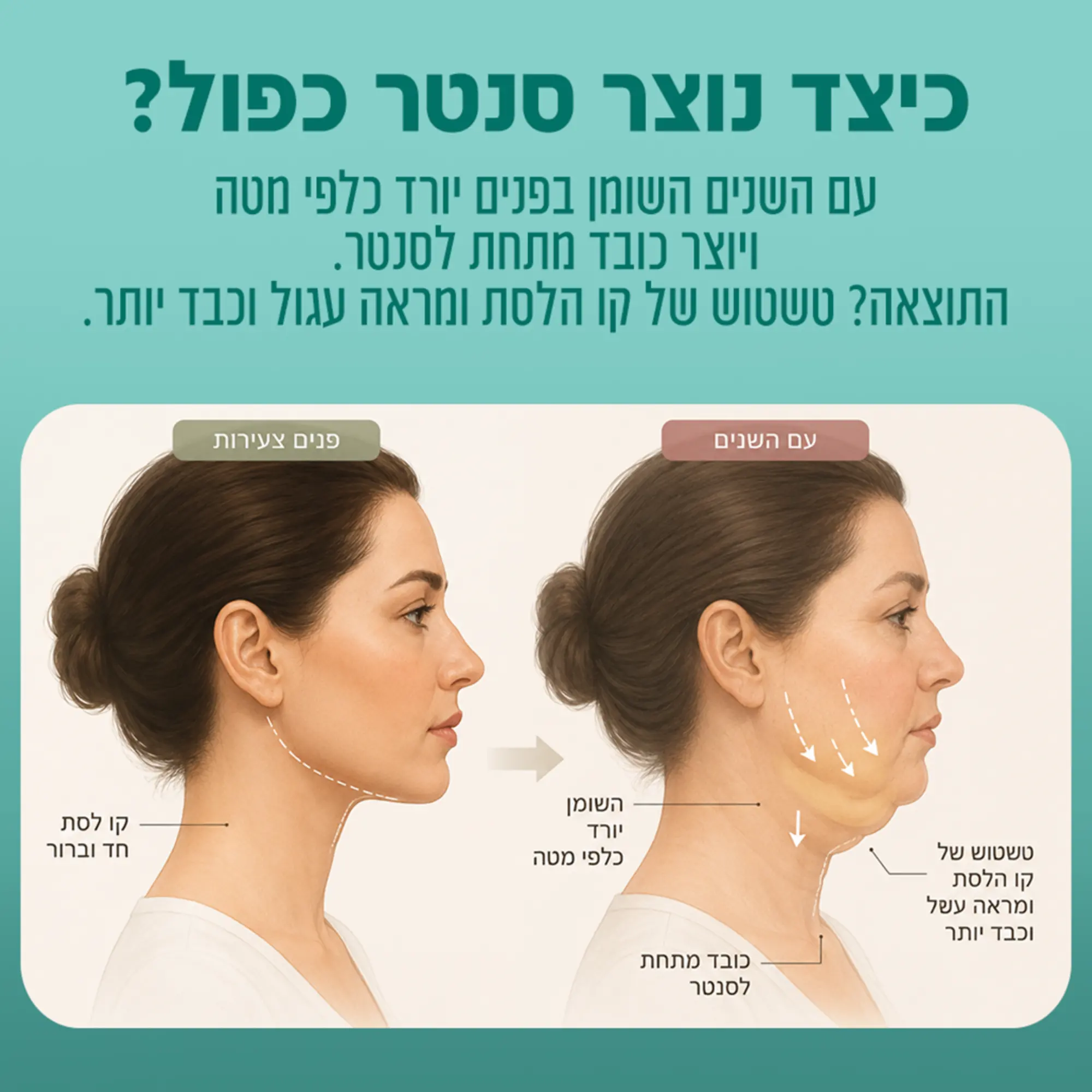 המסת שומן בסנטר שירה כרמי גני תקוה